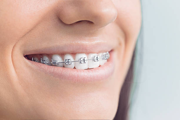 Best Dental Implants  in Hayesville, OR